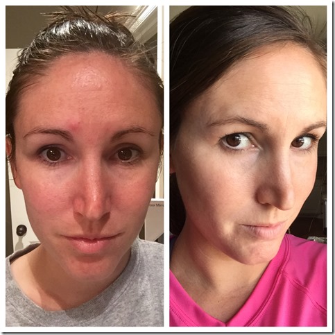 roadn_and_fields roadn_and_fields